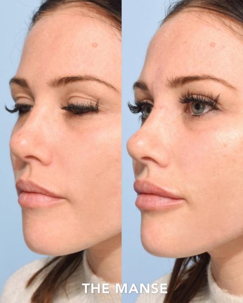 Before and after face treatments including lips