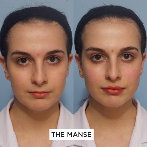 Before and after multiple treatments
