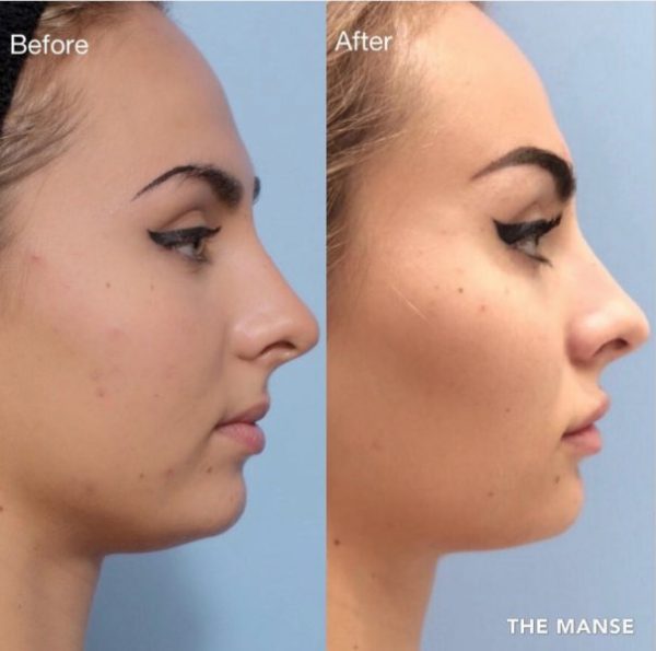 Before and after multiple treatments