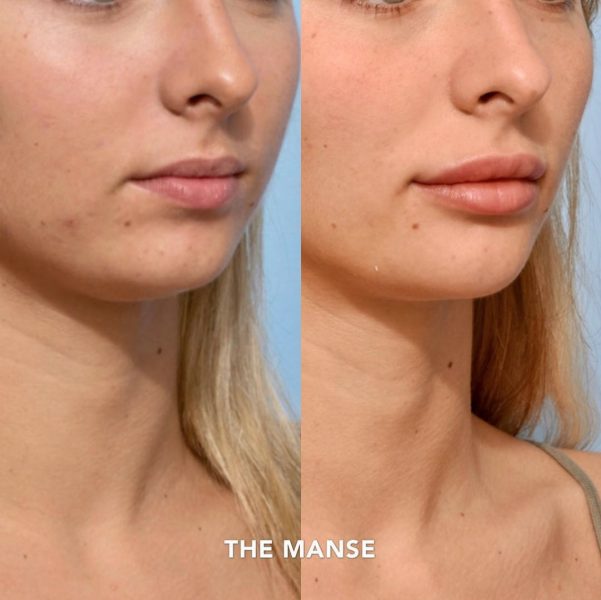 Before and after treatments