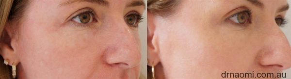 Before and after treatments