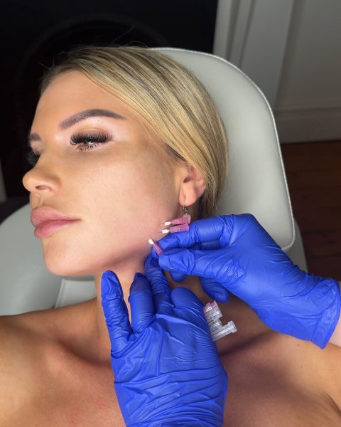 Jawline Rejuvenation