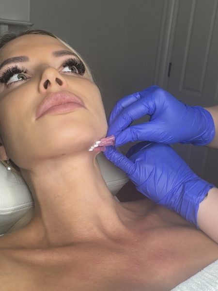 Jawline treatments