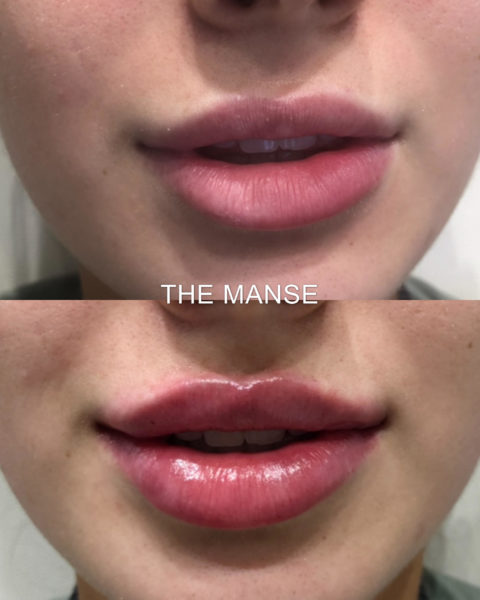 Lips