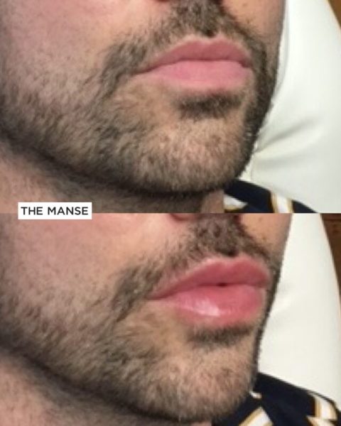 Male lips before and after