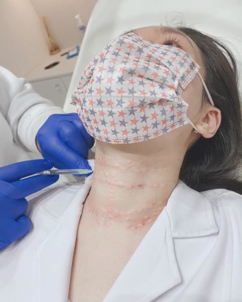 Skinboosters for the neck