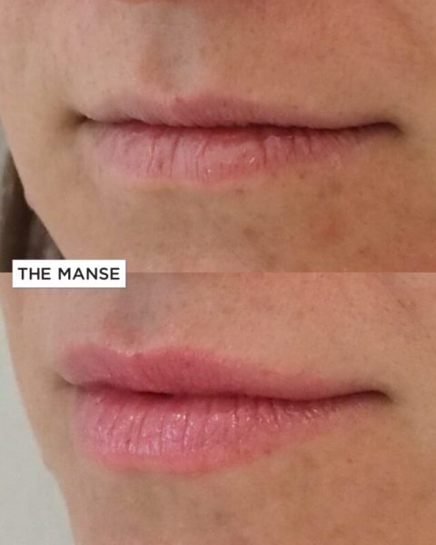Subtle lips