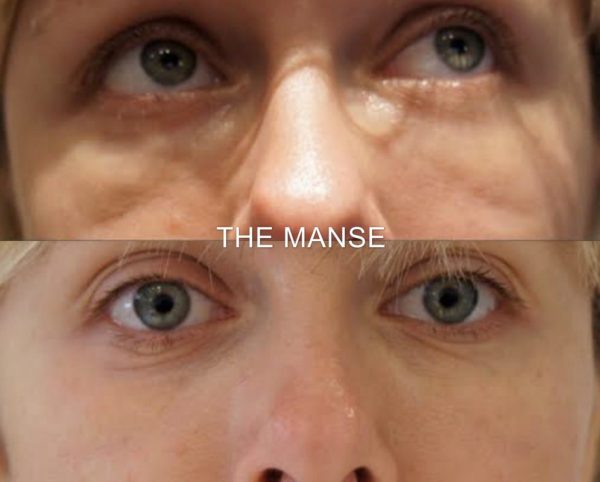 Before and after dissolving 