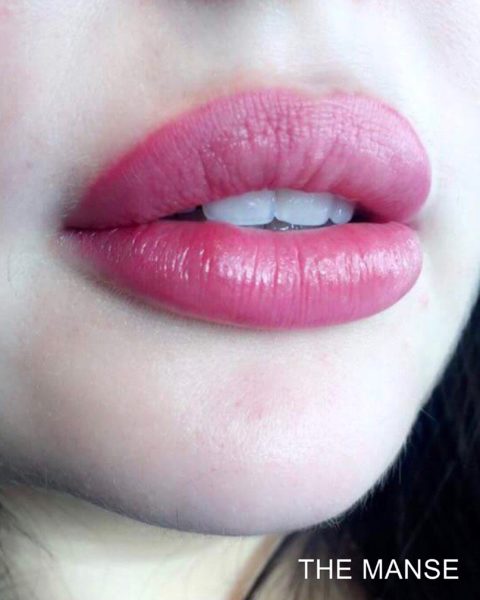 After Lip Treatment