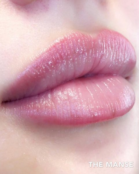 After Lip Treatment