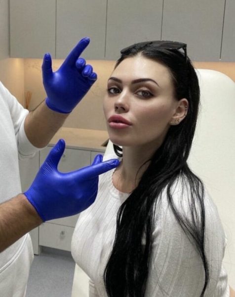 Lip Treatment