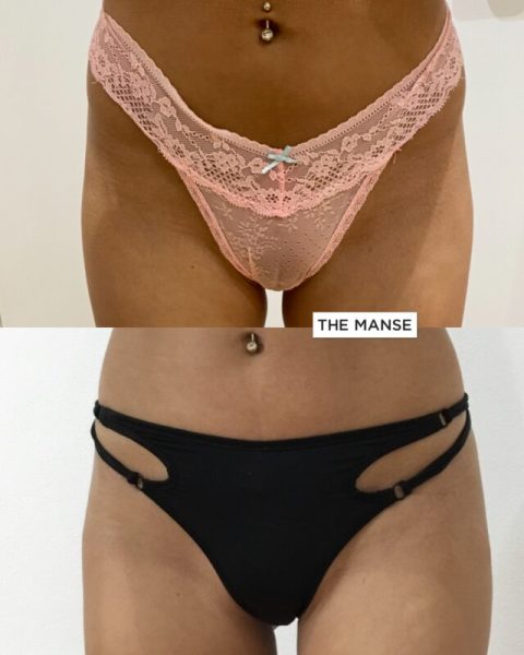 Hip dips treatment